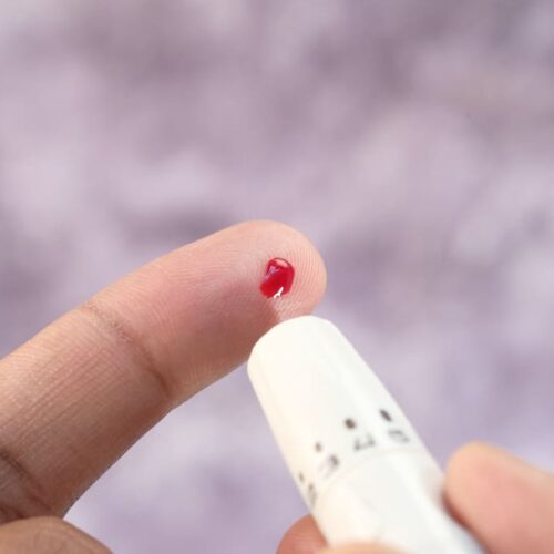 Innovación para la diabetes en Panamá: conoce Prodigy AutoCode